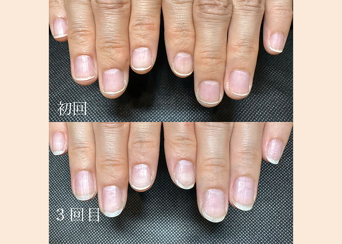 フットマグネットネイル（10本）