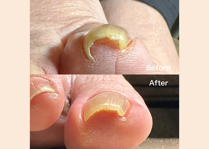 フットマグネットネイル（10本）